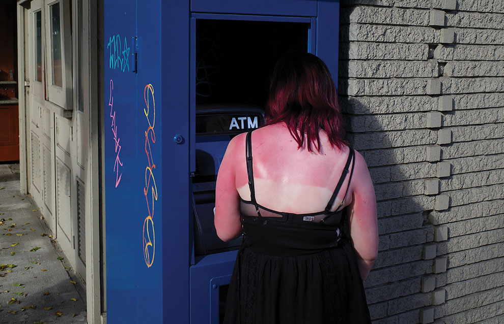 a person stands in front of an ATM with sunburnt shoulders